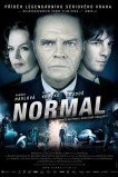 Нормальный