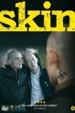 Скин